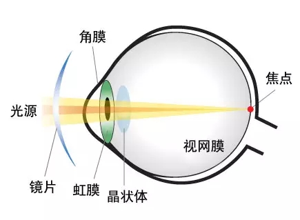 > 散光的成因及验配方法