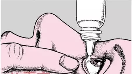 外用眼药,怎么选,怎么用,你 知道多少呢?