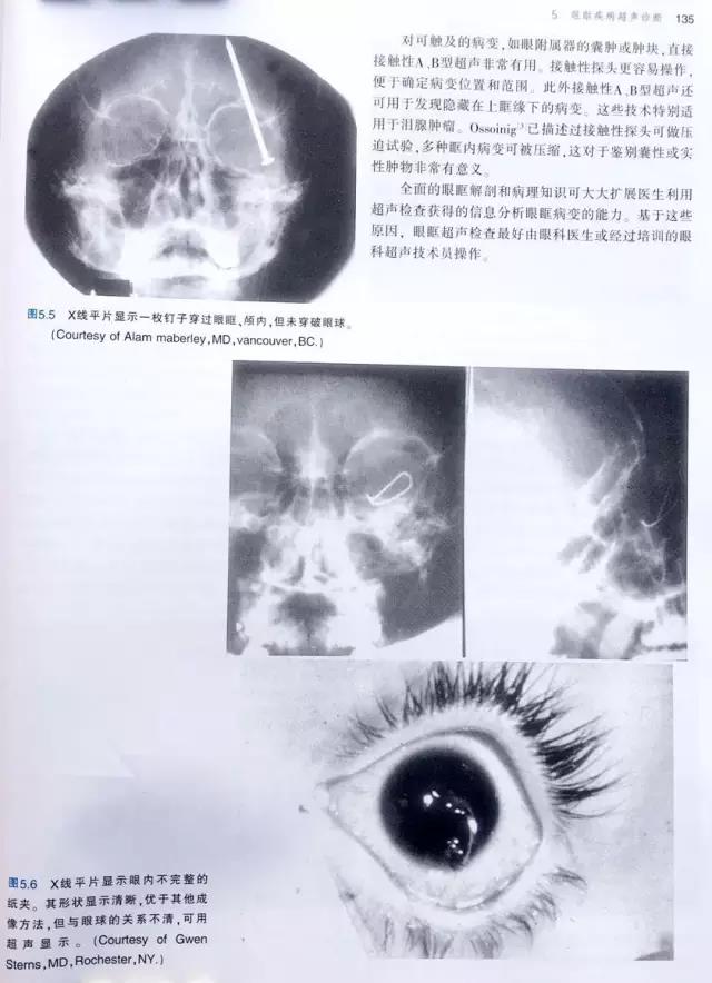 经典图书推荐：眼和眼眶超声学