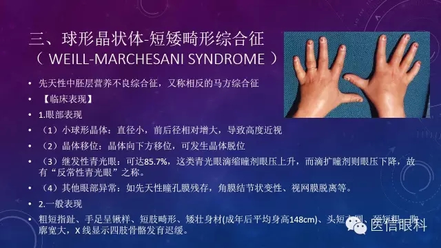 眼科常见综合征