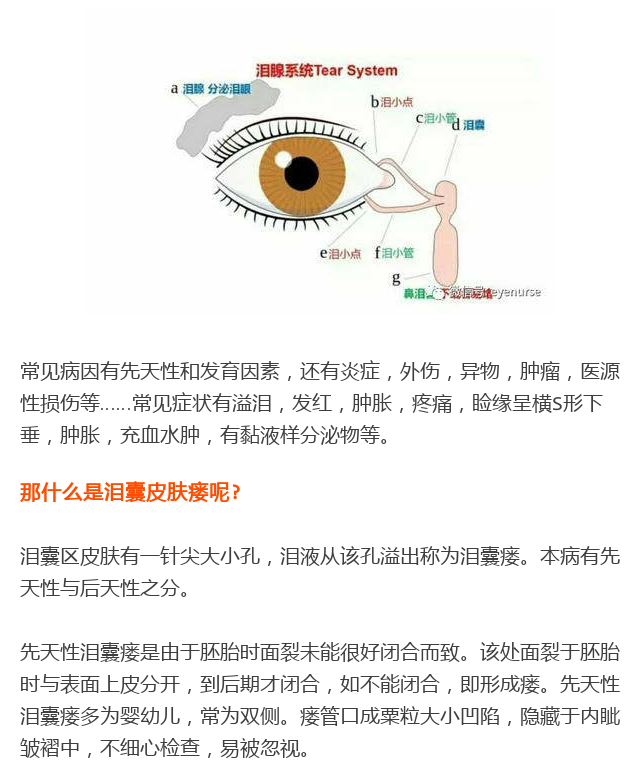 托吡卡胺滴眼液危害图片