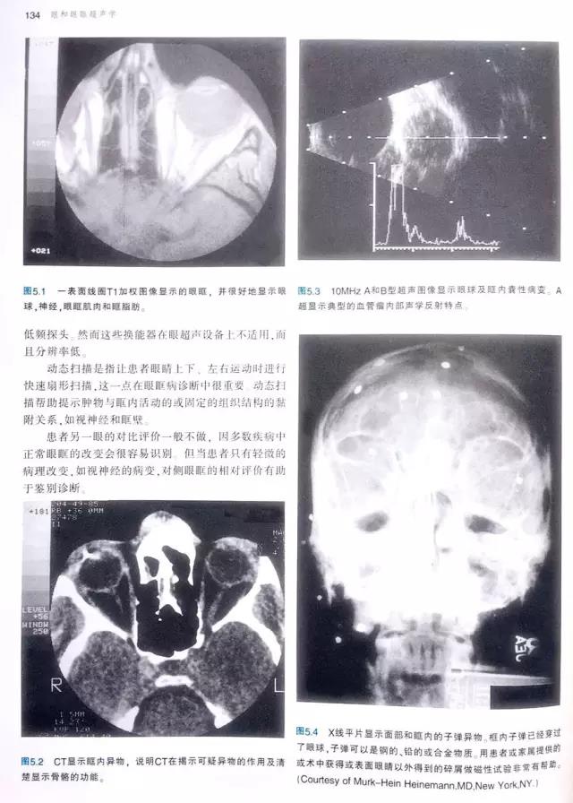 经典图书推荐：眼和眼眶超声学