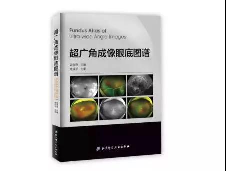 荐书丨《OCT血管造影》&《超广角成像眼底图谱》_中国眼科网_www.yanke360.com