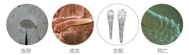 神奇！用筷子滚一滚、揉一揉，就可以将眼睛里的虫子赶出来？——没那么简单！