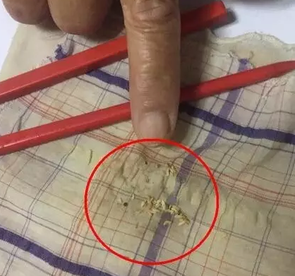 神奇！用筷子滚一滚、揉一揉，就可以将眼睛里的虫子赶出来？——没那么简单！