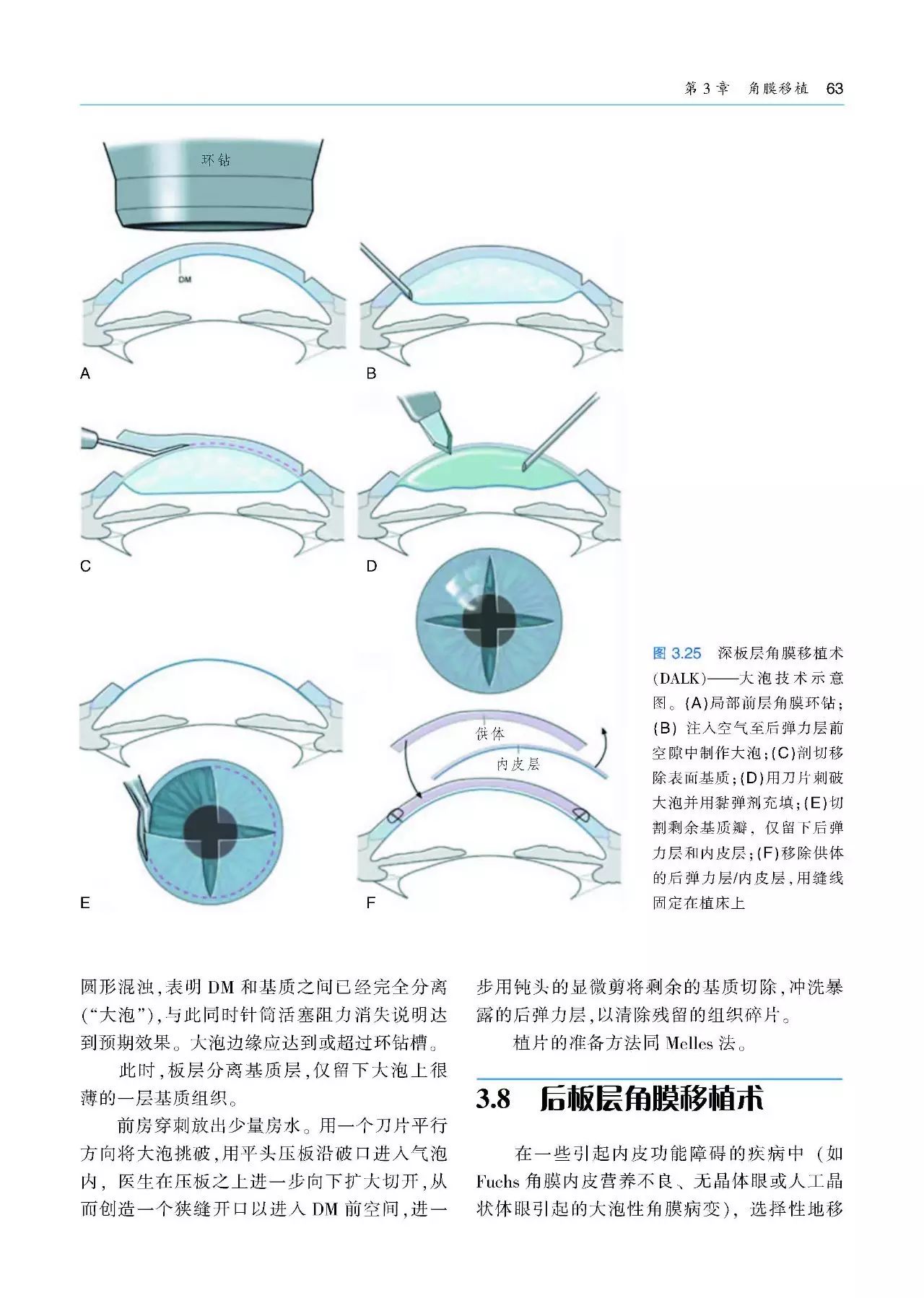好书推荐：角膜手术基本技术（附赠原版DVD手术视频1张）