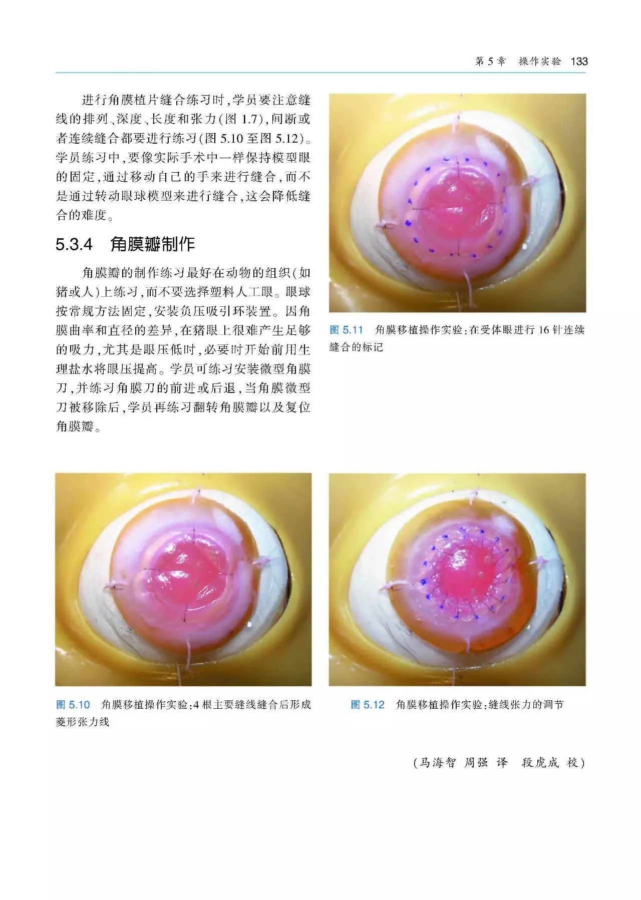 好书推荐：角膜手术基本技术（附赠原版DVD手术视频1张）