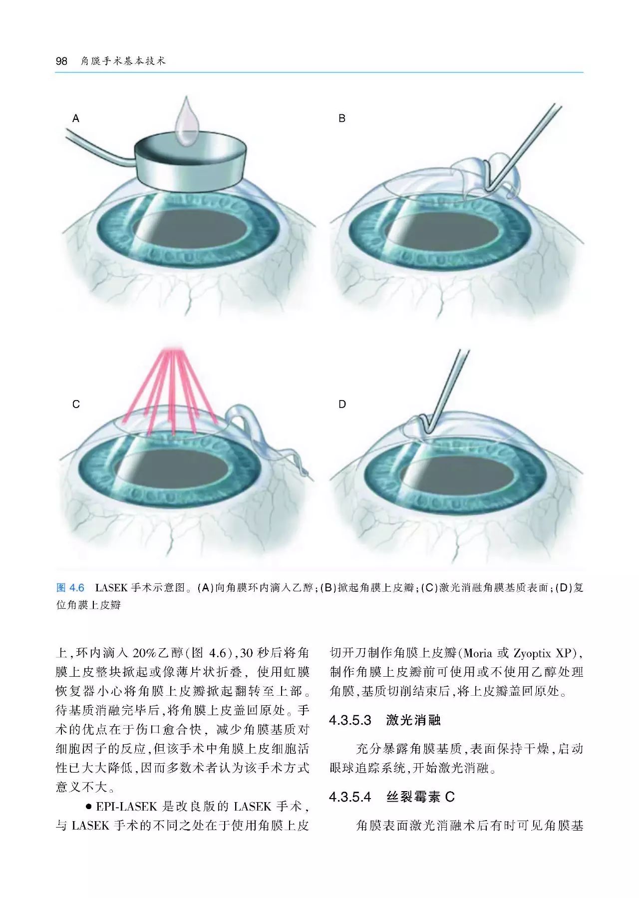 好书推荐：角膜手术基本技术（附赠原版DVD手术视频1张）