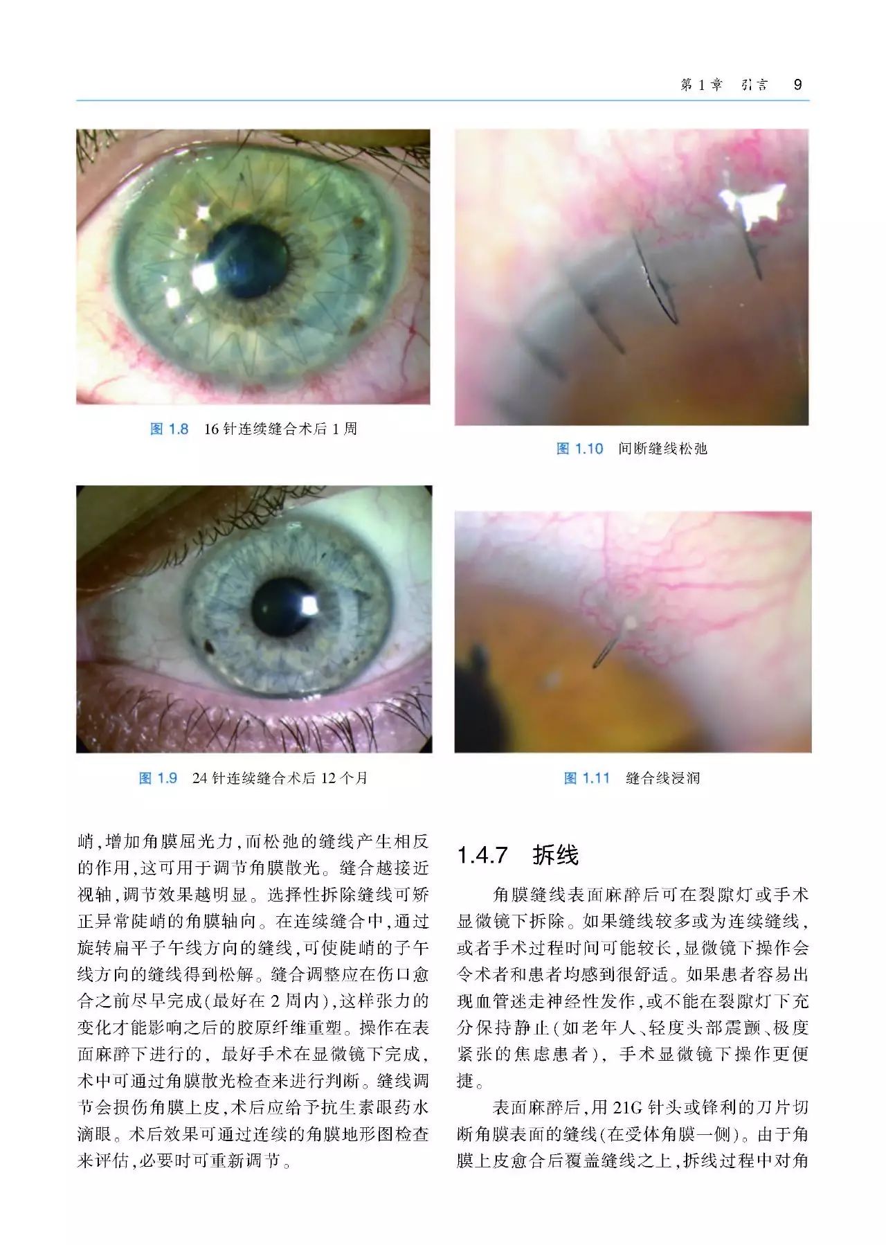 好书推荐：角膜手术基本技术（附赠原版DVD手术视频1张）