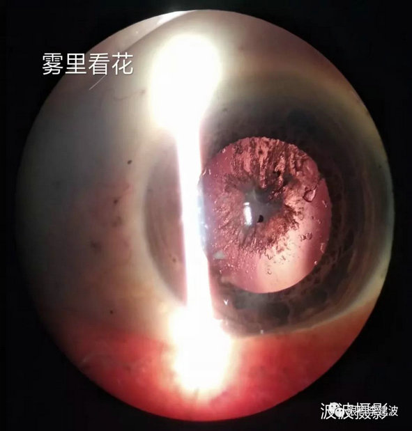 波波裂隙灯下摄影作品