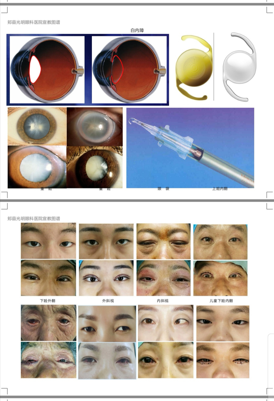 超实用眼病宣教图谱