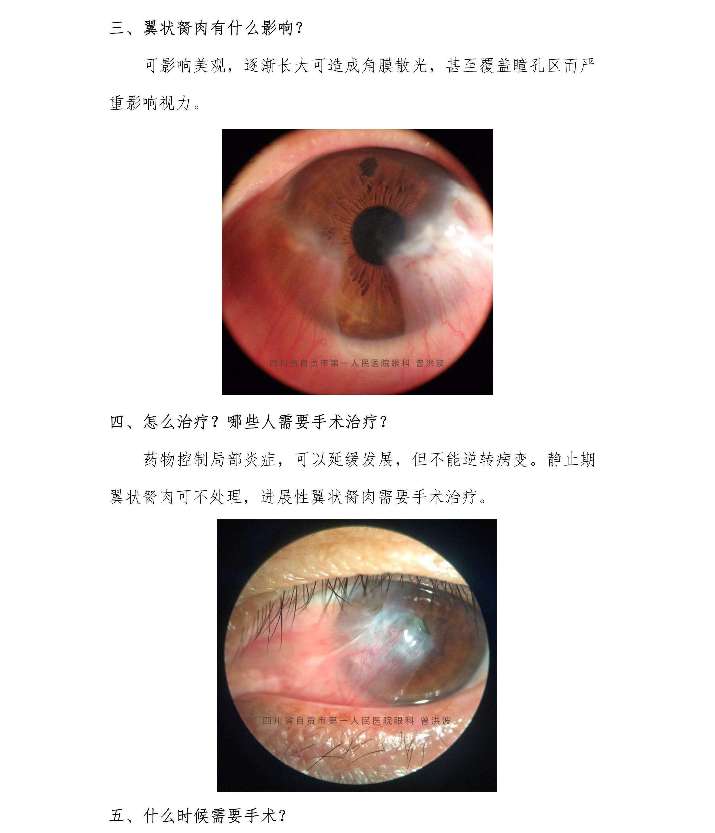 com/news/眼科,中国眼科,眼科医生,眼科医院,中国眼科医生,中国眼科