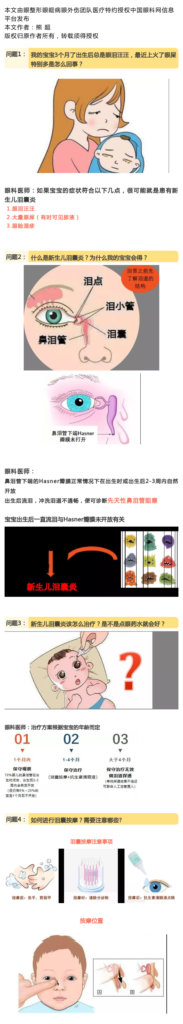 泪眼朦胧的宝宝-——新生儿泪囊炎_www.yanke360.com
