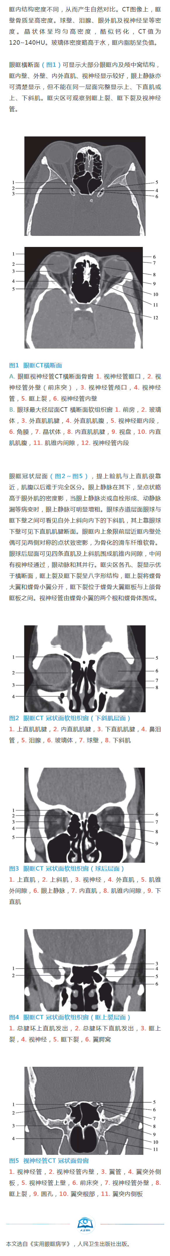 建议收藏|正常眼眶结构的CT 表现_www.yanke360.com